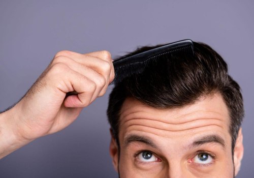 Everything You Need to Know Before Getting a Hair Transplant